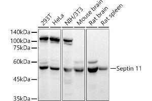 Western blot analysis of extracts of various cell lines, using Septin 11 antibody (ABIN6129126, ABIN6147548, ABIN6147550 and ABIN6215781) at 1:4890 dilution. (Septin 11 anticorps  (AA 1-120))