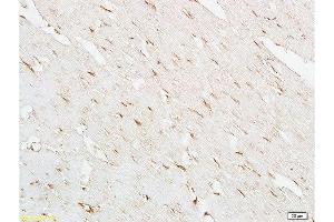 Formalin-fixed and paraffin embedded: rat heart tissue labeled with Anti-NOS-3/eNOS Polyclonal Antibody , Unconjugated at 1:200 followed by conjugation to the secondary antibody and DAB staining