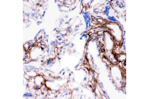 Anti-Collagen I antibody, IHC(F): Human Placenta Tissue (COL1A1 anticorps  (C-Term))