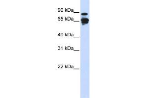 WB Suggested Anti-AMPH Antibody Titration: 0. (Amphiphysin anticorps  (N-Term))