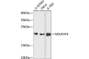Western blot analysis of extracts of various cell lines, using NDUF antibody (ABIN7268807) at 1:3000 dilution. (NDUFAF4 anticorps  (AA 1-170))