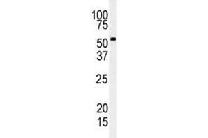 Western blot analysis of RIPK3 antibody and mouse cerebellum tissue lysate.