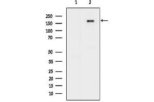 Western blot analysis of lysates from H2O2 treated EC304 cells, using Phospho-IGF1R (Tyr1161) Antibody.