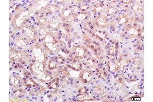 Formalin-fixed and paraffin embedded rat kidney labeled with Rabbit Anti K Cadherin Polyclonal Antibody, Unconjugated (ABIN715286) at 1:200 followed by conjugation to the secondary antibody and DAB staining (CDH6 anticorps  (AA 281-380))