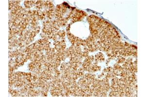 Formalin-fixed, paraffin-embedded human Parathyroid stained with PTH Mouse Recombinant Monoclonal Antibody (rPTH/911). (Recombinant PTH anticorps  (AA 1-34))