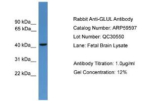 WB Suggested Anti-GLUL  Antibody Titration: 0. (GLUL anticorps  (C-Term))