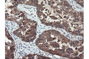 Image no. 1 for anti-Ubiquitin-Conjugating Enzyme E2E 3 (UBE2E3) antibody (ABIN1501617)