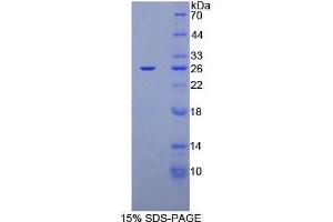 SDS-PAGE analysis of Human CA125 Protein. (MUC16 Protéine)