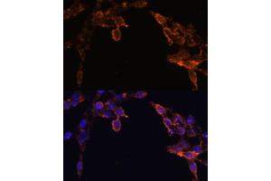 Immunofluorescence analysis of HeLa cells using CYPOR Polyclonal Antibody (ABIN6130227, ABIN6145969, ABIN6145970 and ABIN7101824) at dilution of 1:100 (40x lens).