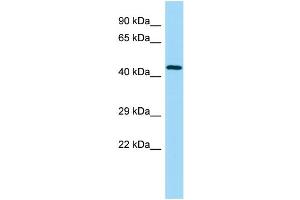 WB Suggested Anti-UBE2Q2 Antibody Titration: 1. (UBE2Q2 anticorps  (Middle Region))