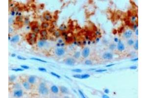 Image no. 1 for anti-Glutathione Peroxidase 4 (GPX4) (C-Term), (Isoform A) antibody (ABIN374711) (GPX4 anticorps  (C-Term, Isoform A))