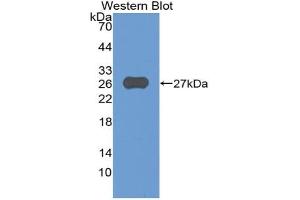 Western blot analysis of the recombinant protein. (ADAM8 anticorps  (AA 371-587))