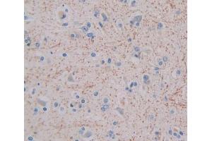 Used in DAB staining on fromalin fixed paraffin- embedded brain tissue