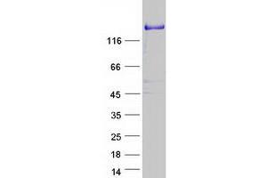 Validation with Western Blot