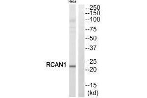 Western blot analysis of extracts from HeLa cells, using RCAN1 antibody. (RCAN1 anticorps  (C-Term))