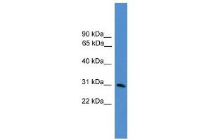 WB Suggested Anti-GTF2E2 Antibody Titration:  0. (GTF2E2 anticorps  (N-Term))