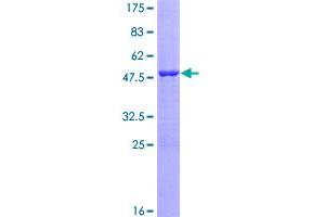 Image no. 1 for Vasoactive Intestinal Peptide (Vip) (AA 1-169) protein (GST tag) (ABIN1325014)
