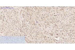 Immunohistochemistry of paraffin-embedded Human uterus tissue using PPIB Monoclonal Antibody at dilution of 1:200.