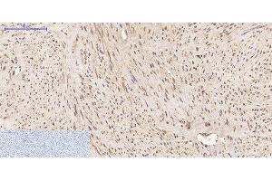 Immunohistochemistry of paraffin-embedded Human uterus tissue using PPIB Monoclonal Antibody at dilution of 1:200. (PPIB anticorps)