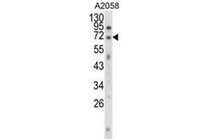 Western blot analysis of EWSR1 Antibody (C-term) in A2058 cell line lysates (35ug/lane). (EWSR1 anticorps  (C-Term))