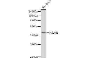 Western blot analysis of extracts of Rat brain, using NSUN5 antibody (ABIN7268955) at 1:1000 dilution. (NSUN5 anticorps  (AA 277-466))