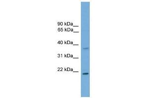 GSTM1 antibody used at 0. (GSTM1 anticorps  (C-Term))