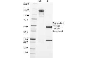 SDS-PAGE Analysis Purified Cytokeratin 20 (KRT20) Mouse Monoclonal Antibody (KRT20/1992). (KRT20 anticorps  (AA 196-323))