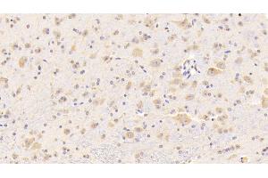 Detection of CTSD in Mouse Cerebrum Tissue using Polyclonal Antibody to Cathepsin D (CTSD) (Cathepsin D anticorps  (AA 66-410))