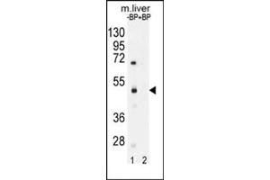 Western blot analysis of SAMD8 Antibody (N-term) Cat. (SAMD8 anticorps  (N-Term))