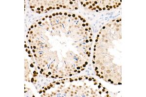 Immunohistochemistry of paraffin-embedded mouse testis using PCNA antibody (ABIN6133630, ABIN6139020, ABIN6139022 and ABIN7101400) at dilution of 1:2700 (40x lens). (PCNA anticorps)