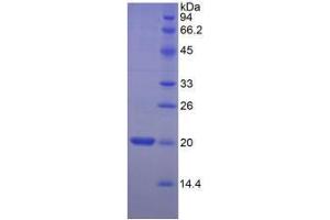 SDS-PAGE analysis of Human MYL2 Protein. (MYL2 Protéine)