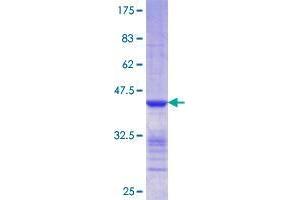 Image no. 1 for Chloride Intracellular Channel 5 (CLIC5) (AA 91-190) protein (GST tag) (ABIN1349687)