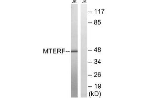 Western blot analysis of extracts from Jurkat cells, using MTERF antibody. (MTERF anticorps  (Internal Region))