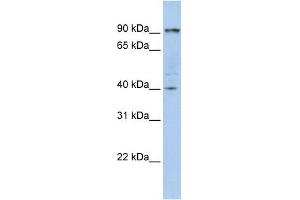 PYGB antibody used at 1 ug/ml to detect target protein.