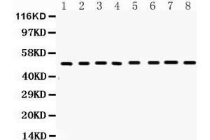 Western blot analysis of FAS expression in mouse liver extract ( Lane 1), mouse spleen extract ( Lane 2), mouse brain extract ( Lane 3) mouse kidney extract ( Lane 4), mouse thymus extract ( Lane 5), mouse lung extract ( Lane 6), HEPA1-6 whole cell lysates ( Lane 7) and NIH3T3 whole cell lysates ( Lane 8).