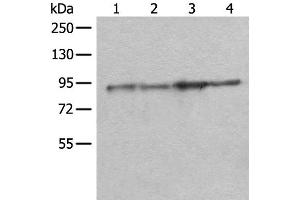 Western blot analysis of Rat brain tissue Mouse brain tissue A549 and PC-3 cell lysates using DDX1 Polyclonal Antibody at dilution of 1:300 (DDX1 anticorps)