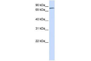 FERMT1 antibody used at 1 ug/ml to detect target protein.