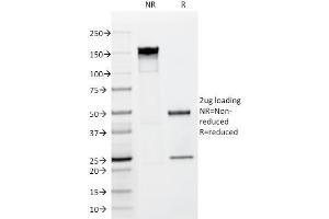 SDS-PAGE Analysis Purified FGF23 Mouse Monoclonal antibody (FGF23/638). (FGF23 anticorps)