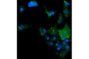 Image no. 2 for anti-Cancer/testis Antigen 1B (CTAG1B) antibody (ABIN1499900) (CTAG1B anticorps)