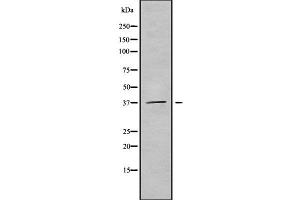 Western blot analysis of B3GALT6 using HuvEc whole cell lysates