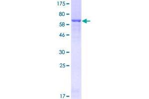 Image no. 1 for Carboxypeptidase B1 (Tissue) (CPB1) (AA 14-417) protein (GST tag) (ABIN1350178)