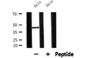 Western blot analysis of extracts from Hela, using AGPAT5 Antibody. (AGPAT5 anticorps  (Internal Region))