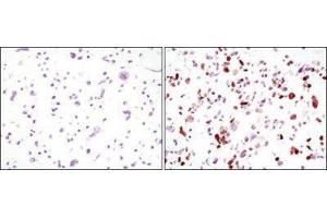 Immunohistochemistry (IHC) image for anti-Green Fluorescent Protein (GFP) antibody (ABIN1843725) (GFP anticorps)
