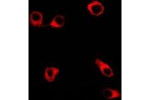 Immunofluorescent analysis of Clusterin staining in SW480 cells. (Clusterin anticorps)