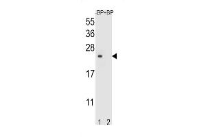 Western blot analysis of T4S4 Antibody (N-term) Pab (ABIN653705 and ABIN2843022) pre-incubated without(lane 1) and with(lane 2) blocking peptide in liver cell line lysate. (TM4SF4 anticorps  (N-Term))