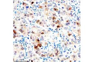 IHC analysis of Hsc70 using anti-Hsc70 antibody (ABIN7601962). (Hsc70 anticorps  (AA 520-614))