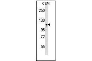 Western blot analysis of DNMT3A Antibody (C-term) in CEM cell line lysates (35ug/lane). (DNMT3A anticorps  (C-Term))