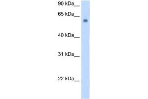 WB Suggested Anti-SLC1A4 Antibody Titration:  0. (SLC1A4 anticorps  (C-Term))