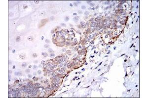 Immunohistochemical analysis of paraffin-embedded esophageal tissues using SRC mouse mAb with DAB staining.