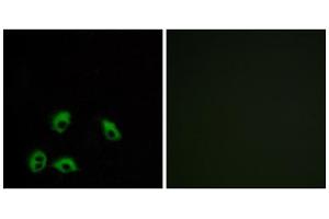 Immunofluorescence analysis of MCF-7 cells, using GPR103 antibody. (QRFPR anticorps  (Internal Region))
